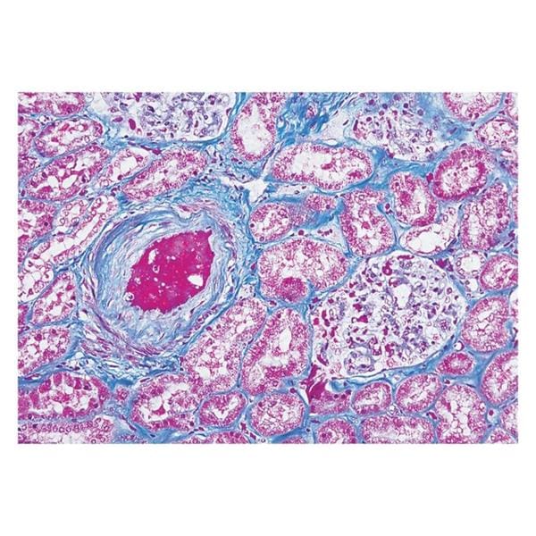 Richard Masson's Trichrome Stain Kit Each Allan Scientific 87019