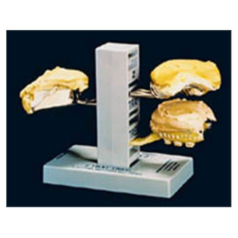 Zimmerman Enterprises -Z-Tray Tree Impression Tray Holder 6 in x 5.5 in x 3.5 in For 6 Poured Trays / 8 Empty Each 701