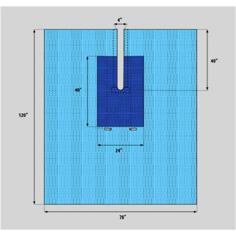 Welmed Inc -77x120" Non-Sterile Surgical Drape Fenestrated 1222-1950