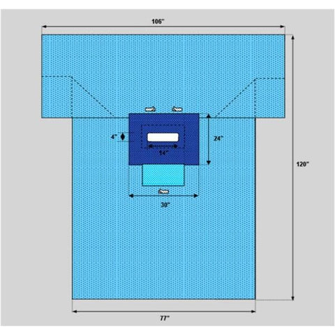 Welmed Inc -106x77x120" Sterile Transverse Laparotomy Drape 14x4" Fenestrated 1222-2130