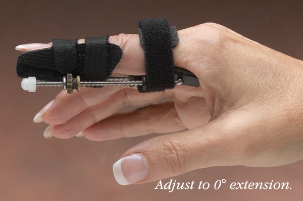 North Coast Static Progressive PIP Finger Extension Splint – Medute