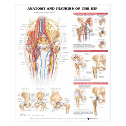 Wolters Kluwer Health Inc Anatomy and Injuries of the Hip 20x26" Anatomical Chart Ea - 9781587793837