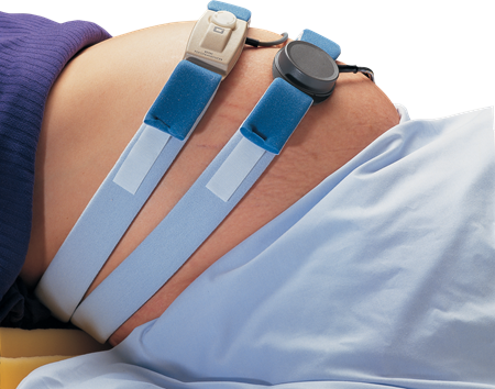 DEROYAL FETAL MONITORING ABDOMINAL STRAPS