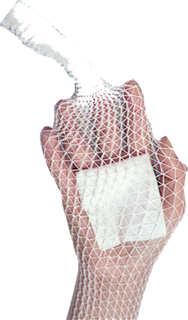 DEROYAL STRETCH NET™ TUBULAR ELASTIC BANDAGE (PACKAGING - EACH)