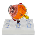 INTRAOCULAR EYE MODEL