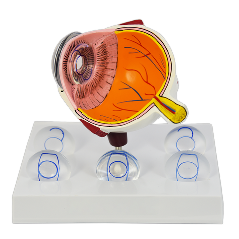 INTRAOCULAR EYE MODEL