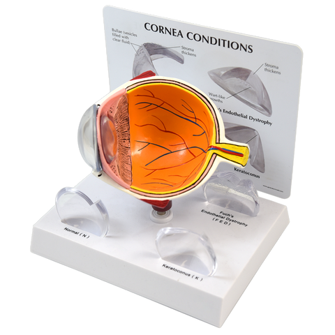 CORNEAL EYE MODEL