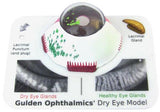 DRY EYE MODEL