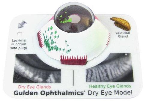 DRY EYE MODEL