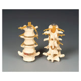 Wolters Kluwer Health Inc Four-Part Lumbar Set Model Anatomical Budget Adult Each - CHLS4