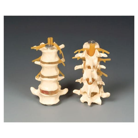 Wolters Kluwer Health Inc Four-Part Lumbar Set Model Anatomical Budget Adult Each - CHLS4
