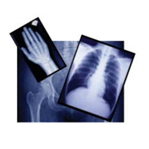 Medlink Imaging Film X-Ray 15x30cm 100/Bx, 5 BX/CA - 55BHW